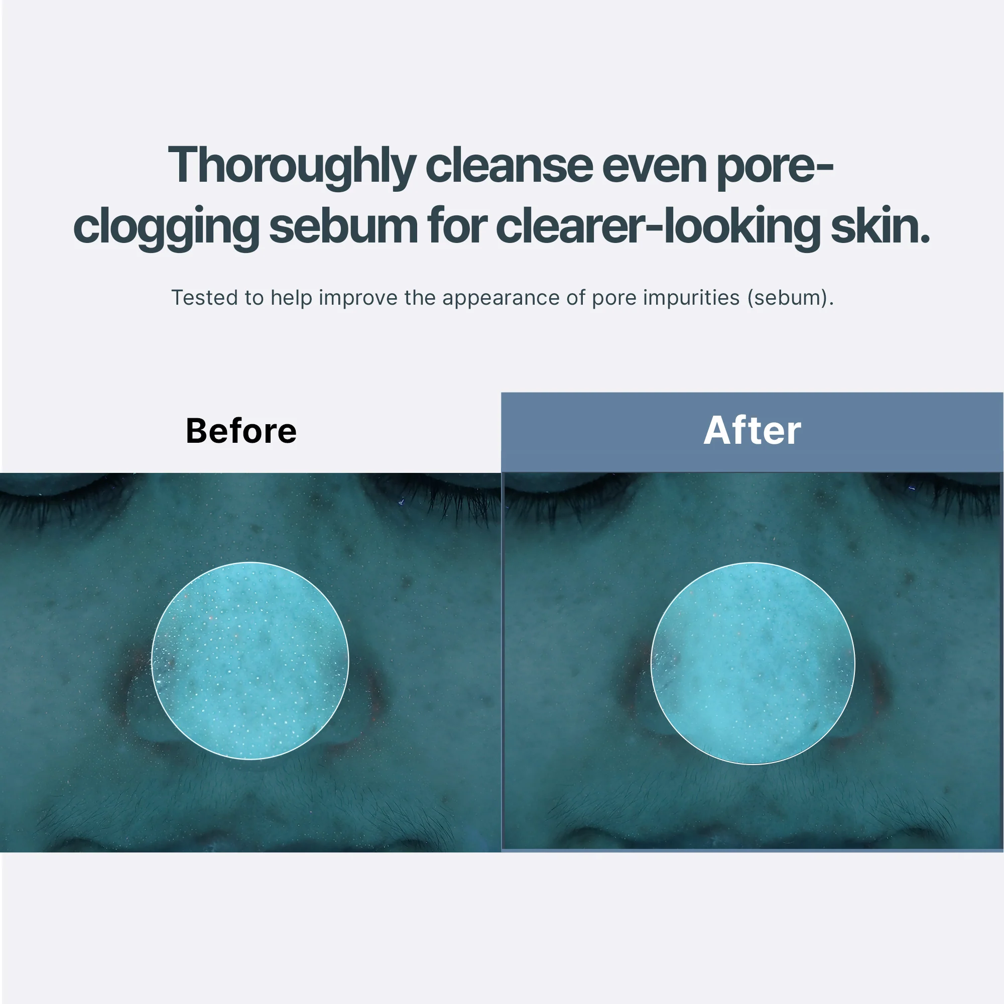 Azulene Acne Foam Cleanser - Image 4