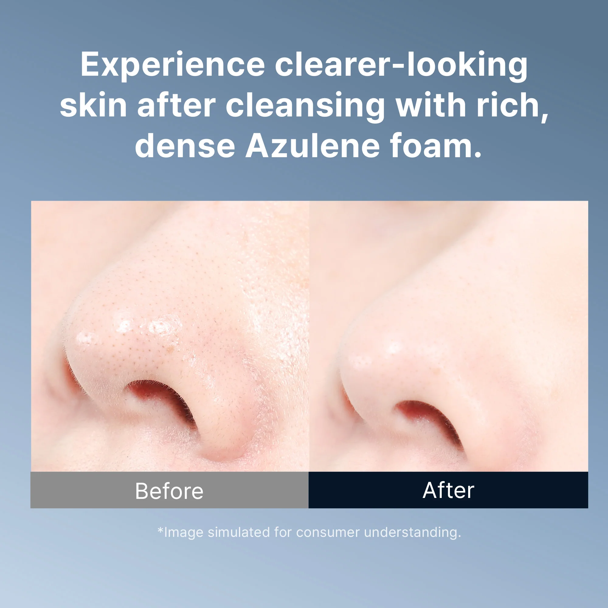 Azulene Acne Foam Cleanser - Image 5